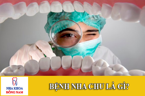 benh nha chu la gi