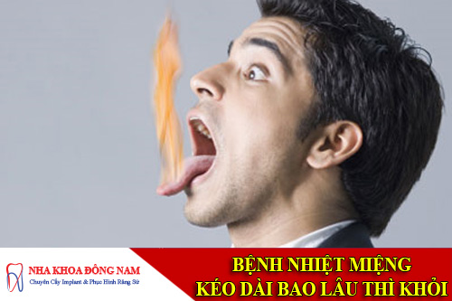 benh nhiet mieng keo dai bao lau