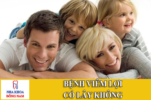 bệnh viêm lợi có lây không