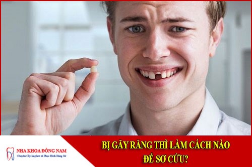 bị gãy răng thì làm cách nào để sơ cứu
