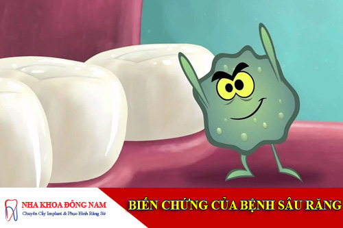 bien chung cua benh sau rang