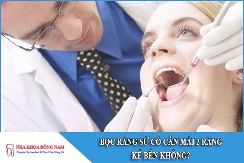 bọc răng sứ có cần mài 2 răng kế bên không