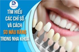 Các Chỉ Số Và Cách So Màu Răng Trong Nha Khoa