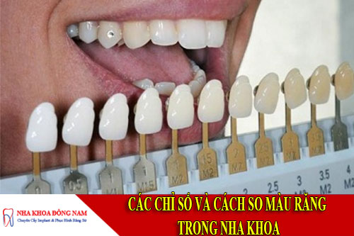 các chỉ số và cách so màu răng trong nha khoa
