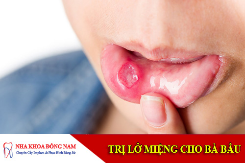 cach chua lo mieng cho ba bau