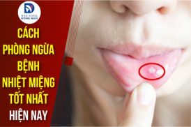 Cách phòng ngừa bệnh nhiệt miệng tốt nhất hiện nay