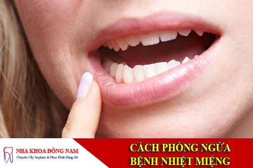 cach phong ngua benh nhiet mieng