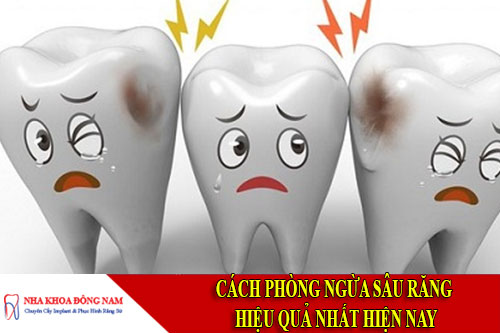 cách phòng ngừa sâu răng hiệu quả nhất hiện nay