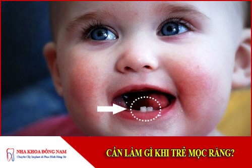 cần làm gì khi trẻ mọc răng