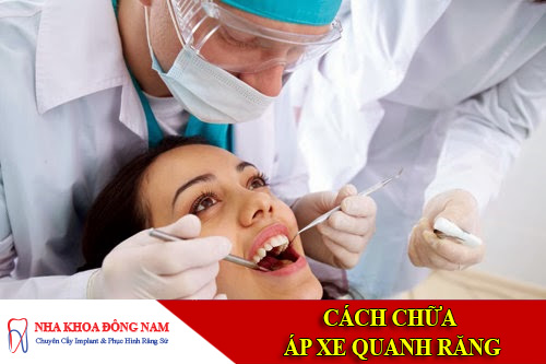 chua ap xe quanh rang