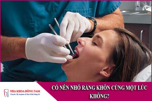 có nên nhổ hai răng khôn cùng một lúc không