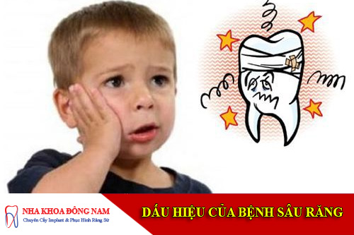 dấu hiệu của bệnh sâu răng