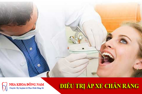 dieu tri ap xe chan rang
