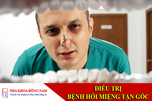 điều trị bệnh hôi miệng
