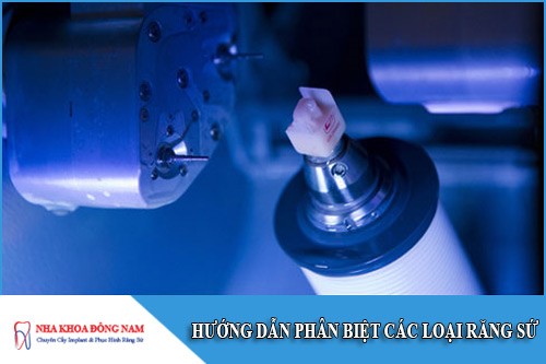 hướng dẫn phân biệt các loại răng sứ