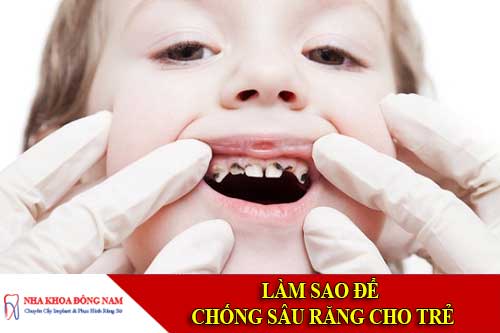 làm sao để chống sâu răng cho trẻ