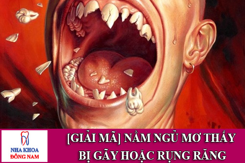 mơ thấy răng bị gãy hoặc rụng