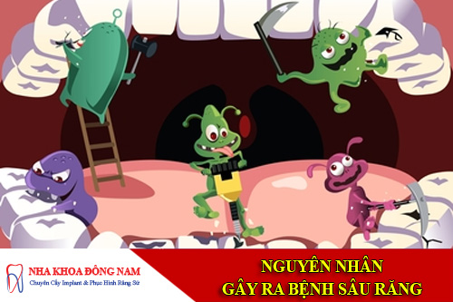 nguyên nhân gây ra bệnh sâu răng
