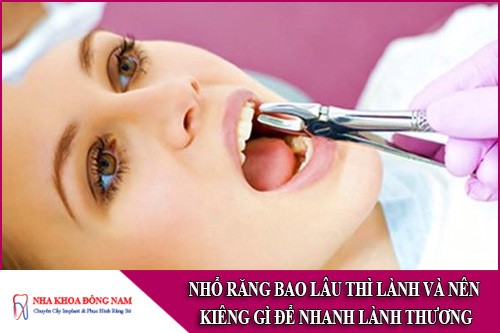 nhổ răng bao lâu thì lành và nên kiêng gì để nhanh lành thương