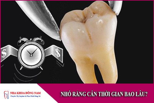 nhổ răng cần thời gian bao lâu