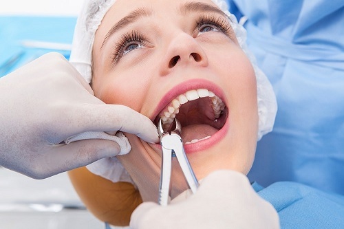 nhổ răng có cần phải xét nghiệm máu không 1
