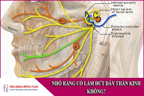 nhổ răng có làm đứt dây thần kinh không