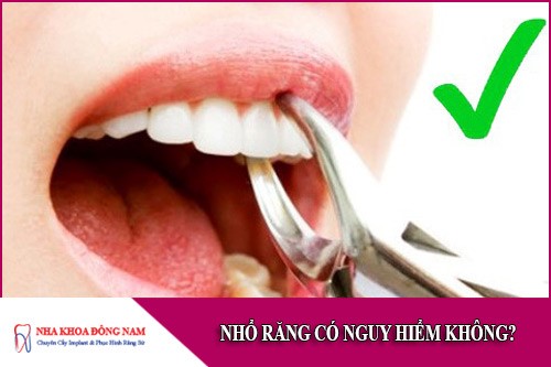nhổ răng có nguy hiểm không