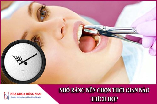 nhổ răng nên chọn thời gian nào