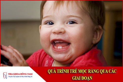 quá trình trẻ mọc răng qua các giai đoạn