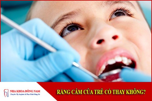 răng cấm của trẻ có thay không