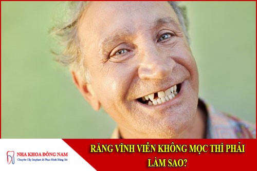 răng vĩnh viễn không mọc thì phải làm sao