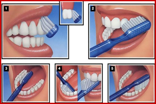 tại sao đánh răng mãi vẫn không sạch 3