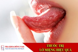 thuoc tri lo mieng hieu qua