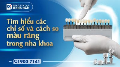 Tìm hiểu các chỉ số và cách so màu răng trong nha khoa