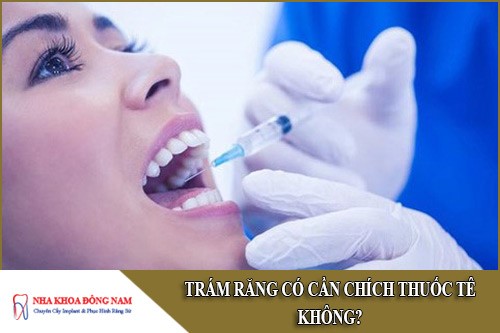 trám răng có cần chích thuốc tê không