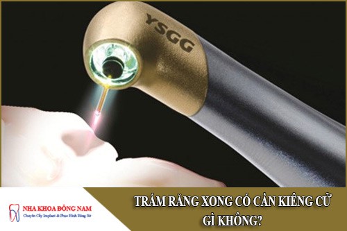 trám răng xong có cần kiêng cử gì không