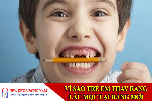 tre em thay rang lau moc lai rang moi