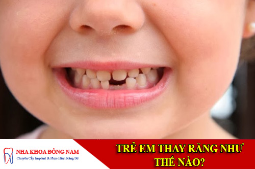 tre em thay rang nhu the nao
