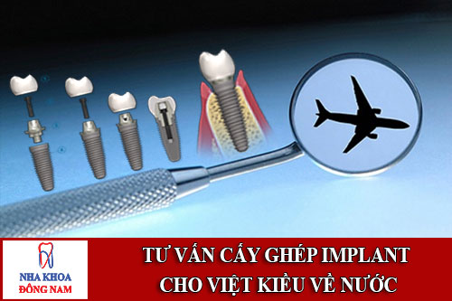 tư vấn cấy ghép implant cho việt kiều về nước