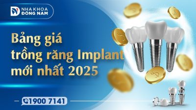 Bảng giá Implant mới nhất 2025 tại Nha Khoa Đông Nam