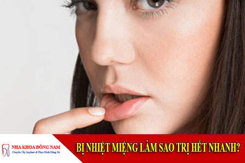 bị nhiệt miệng làm sao trị hết nhanh