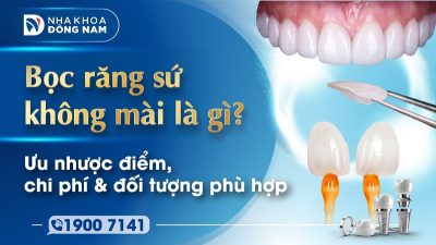 Bọc răng sứ không mài là gì? Ưu nhược điểm, chi phí và đối tượng phù hợp