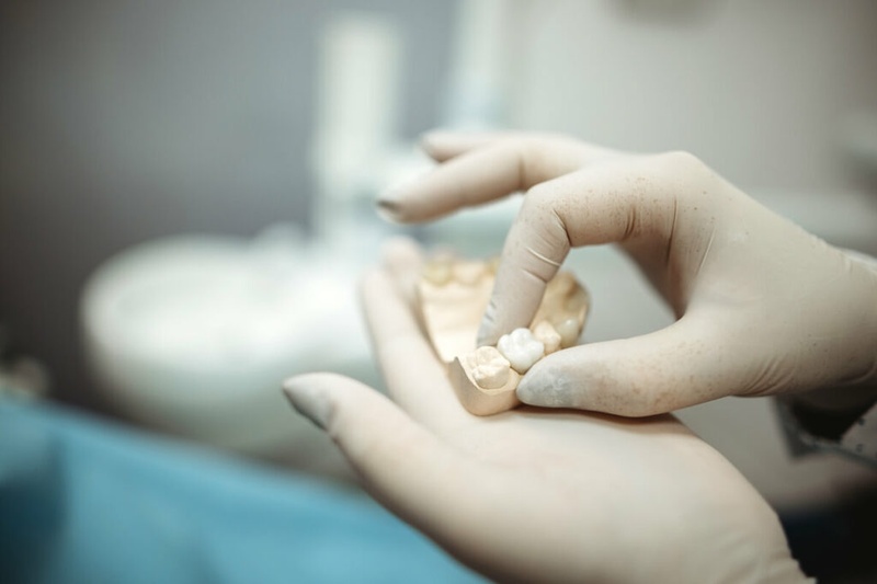 Bọc răng sứ sau điều trị tủy răng bảo vệ mô răng thật lâu dài