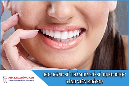 bọc răng sứ thẩm mỹ có sử dụng được vĩnh viễn không