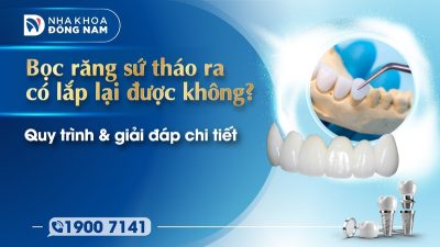 Bọc răng sứ tháo ra có lắp lại được không? Quy trình & giải đáp chi tiết