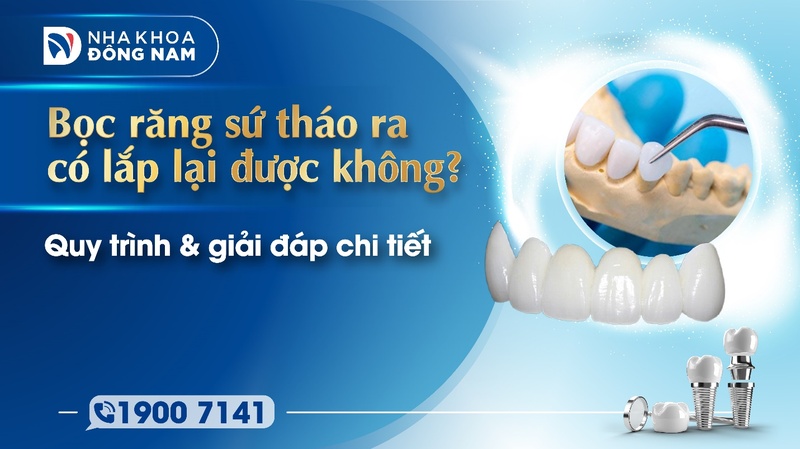 Bọc răng sứ tháo ra có lắp lại được không? Quy trình & giải đáp chi tiết