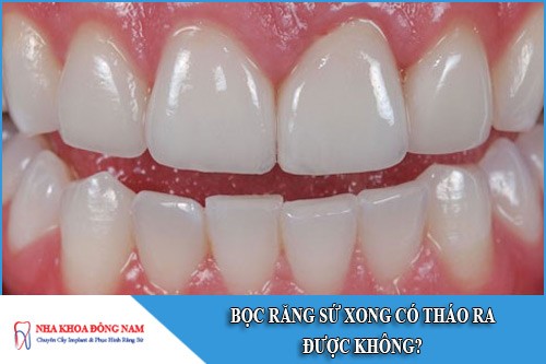 bọc răng sứ xong có tháo ra được không