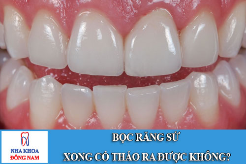 bọc răng sứ xong có tháo ra được không