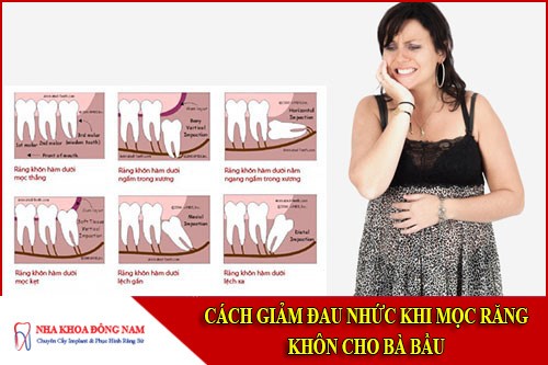 cách giảm đau nhức khi mọc răng khôn cho bà bầu