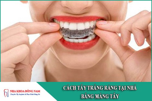 cách tẩy trắng răng tại nhà bằng máng tẩy